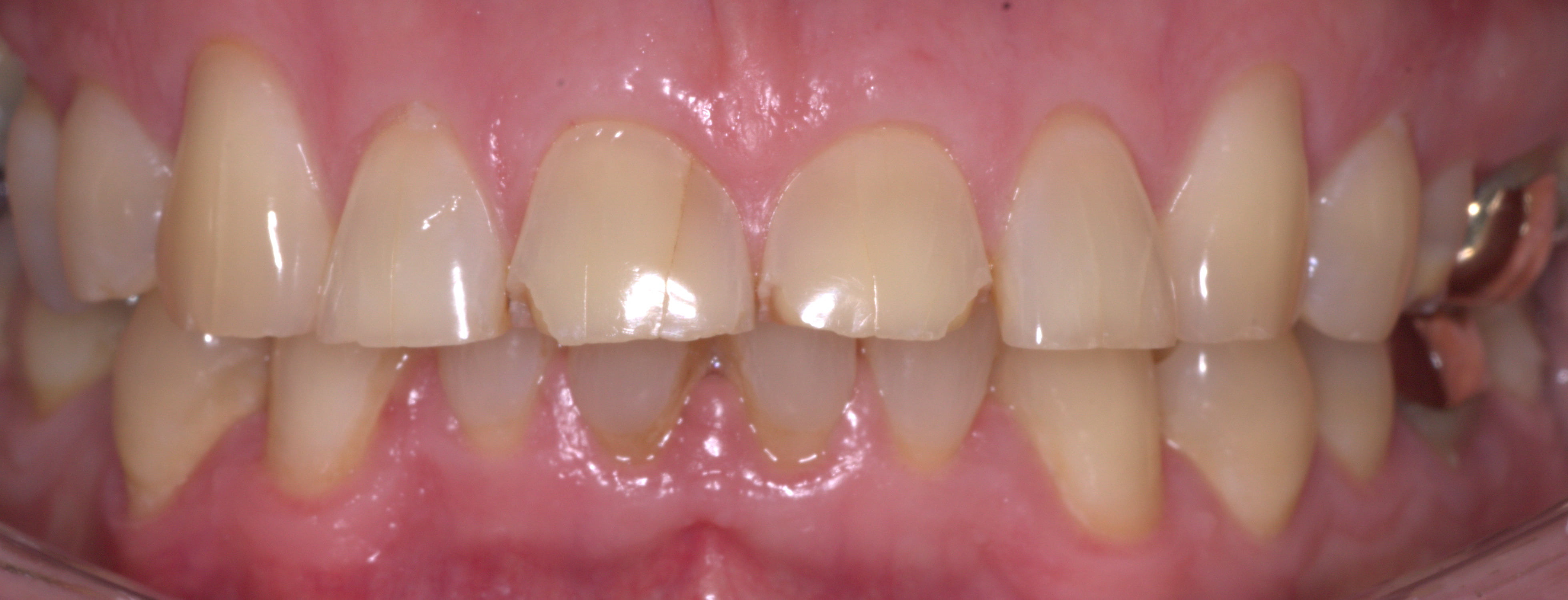 Dentist Burgess Hill Denplan Dentist West Sussex