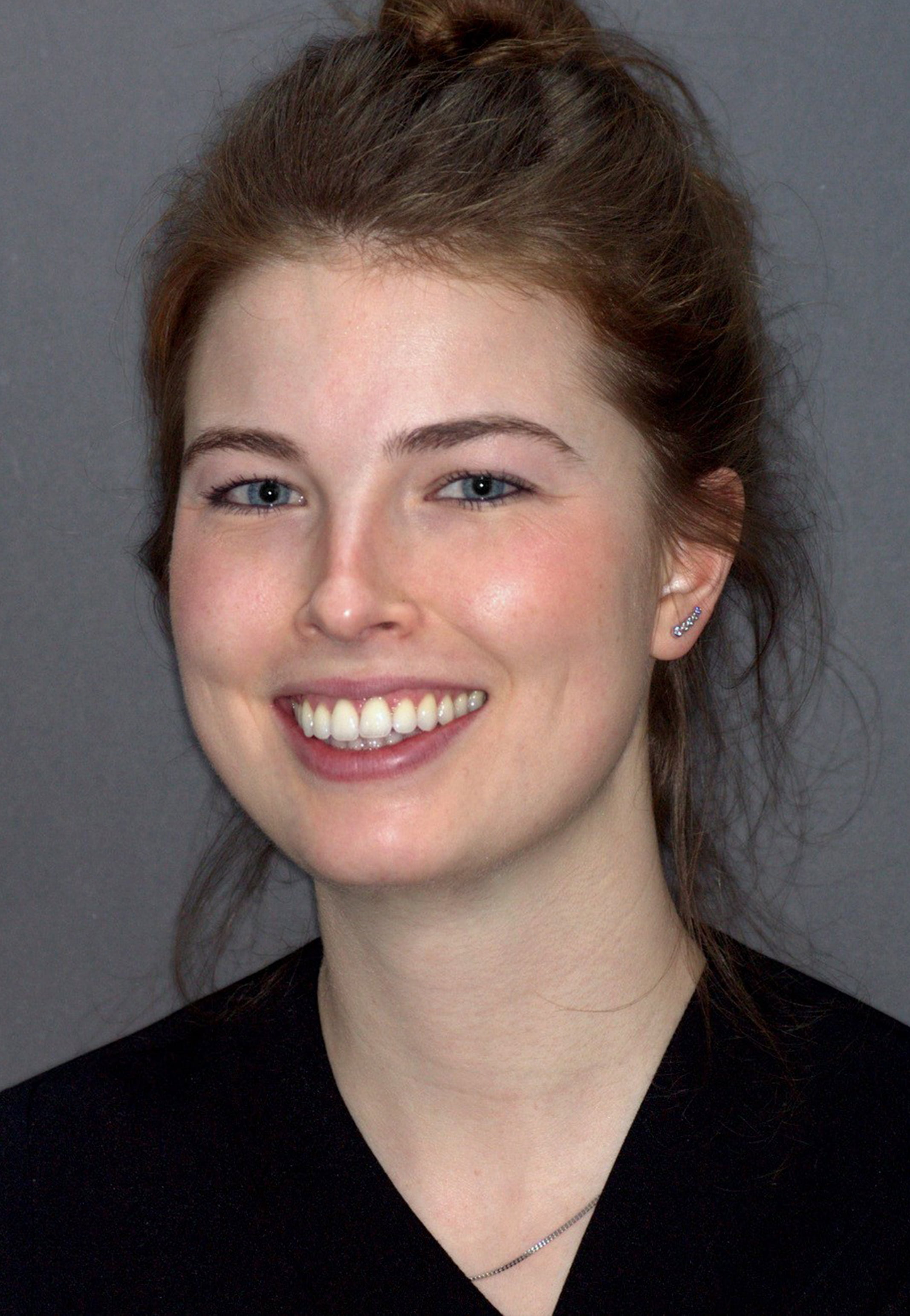 Dentist Burgess Hill Denplan Dentist West Sussex