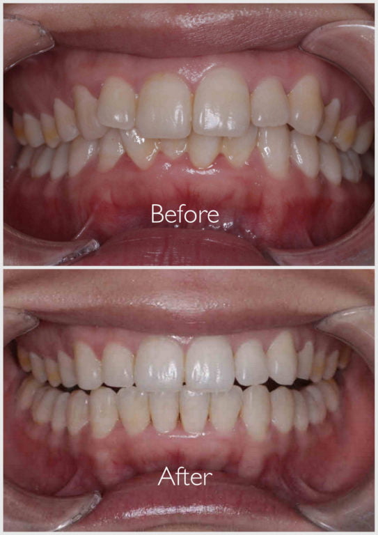 Dentist Burgess Hill Denplan Dentist West Sussex